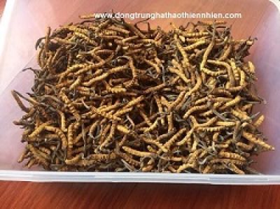 Sai lầm tước đi 'giờ v&agrave;ng' cứu trẻ tay ch&acirc;n miệng