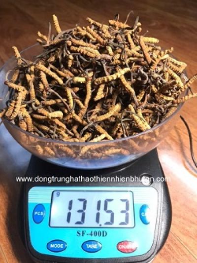 Tăng 20 kg do rối loạn nội tiết