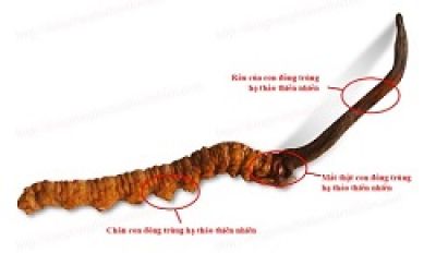 Người phụ nữ chia sẻ trải nghiệm hút mỡ &#039;như bị lột da sống&#039;