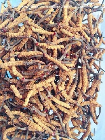 Hơi thở có mùi thịt thiu do suy thận tích tụ urê