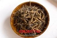 Cứ 500 trẻ chào đời có một bị khe hở môi vòm