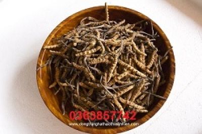 Cô gái bị áp xe miệng sau phẫu thuật tạo má lúm đồng tiền