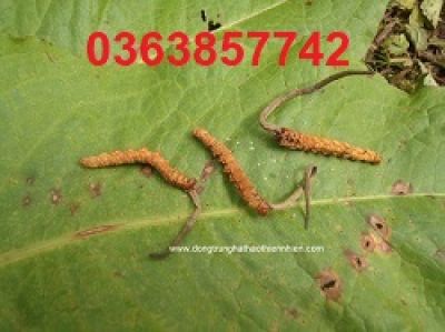 Ph&aacute;t hiện ung thư từ vết n&acirc;u đen ở m&oacute;ng tay