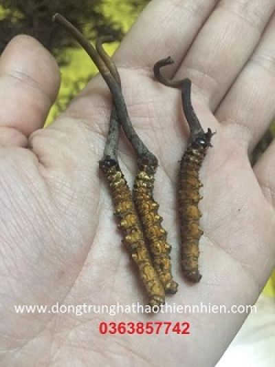 Khi n&agrave;o đau lưng l&agrave; dấu hiệu ung thư?