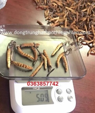 Gắp 3 chiếc bật lửa trong dạ d&agrave;y người đ&agrave;n &ocirc;ng