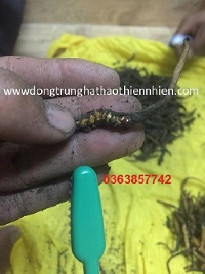 B&eacute; g&aacute;i 19 th&aacute;ng tuổi bị ch&oacute; cắn trọng thương mặt